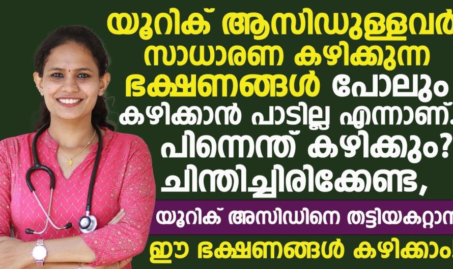 ശരീരത്തിൽ യൂറിക് ആസിഡ് കൂടുന്നത് നിയന്ത്രിക്കാൻ ഈ പറയുന്ന ഭക്ഷണ രീതികൾ ഫോളോ ചെയ്താൽ മതി…