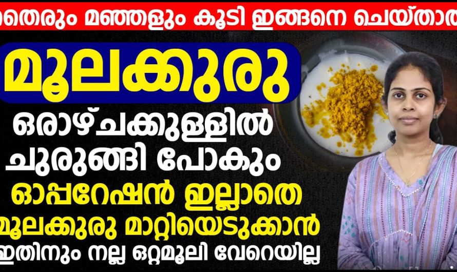 പൈൽസ് അസുഖം മാറ്റാൻ ഇതാ ഒരു ഒറ്റമൂലി ഓപ്പറേഷൻ ഇല്ലാതെ തന്നെ പൈൽസ് മാറ്റിയെടുക്കാം