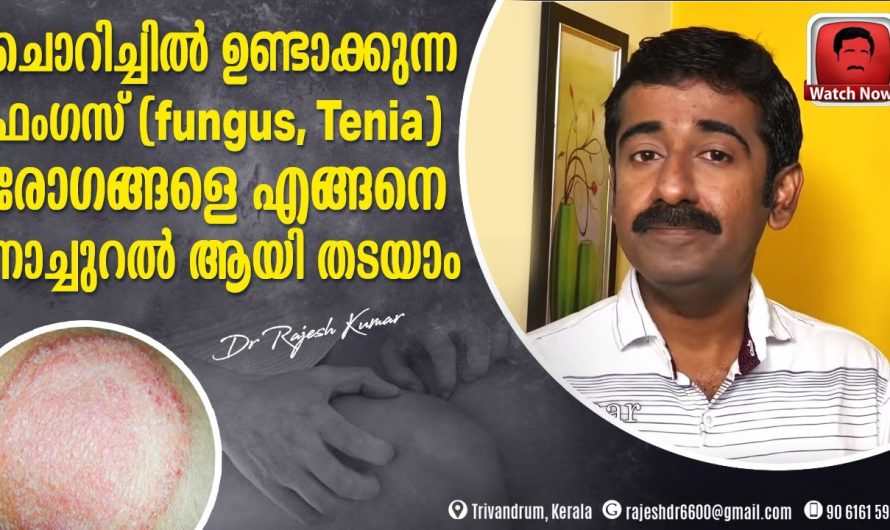 ഇന്ന് പലരെയും അലട്ടുന്ന ഫംഗസ് രോഗങ്ങൾക്ക് പിന്നിലെ പ്രധാനപ്പെട്ട കാരണങ്ങളും പരിഹാര മാർഗങ്ങളെക്കുറിച്ചും അറിയാം…