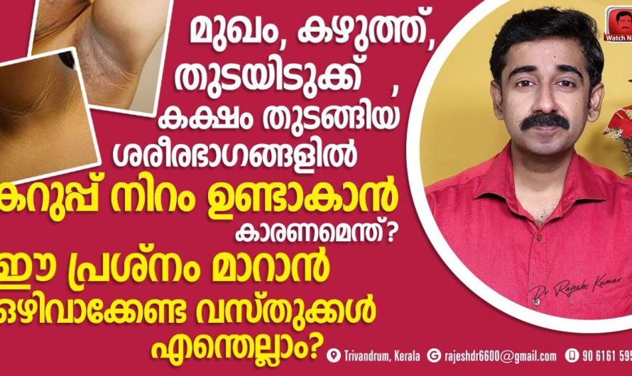 ശരീരത്തിൻറെ പലഭാഗങ്ങളിൽ ഉണ്ടാകുന്ന കറുത്ത ഇരുണ്ട നിറങ്ങൾ ഈസിയായി പരിഹരിക്കാം..