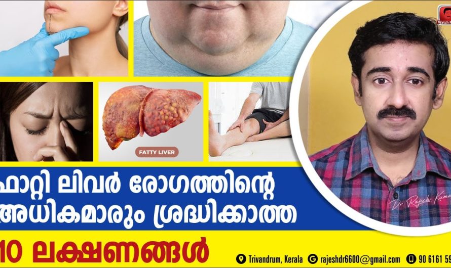 ഈ പറയുന്ന 10 ലക്ഷണങ്ങൾ നിങ്ങളുടെ ശരീരത്തിൽ ഉണ്ടെങ്കിൽ ഉറപ്പിക്കാം നിങ്ങൾ ഒരു ഫാറ്റി ലിവർ രോഗിയാണ് എന്ന്.. വിശദമായ അറിയാം…