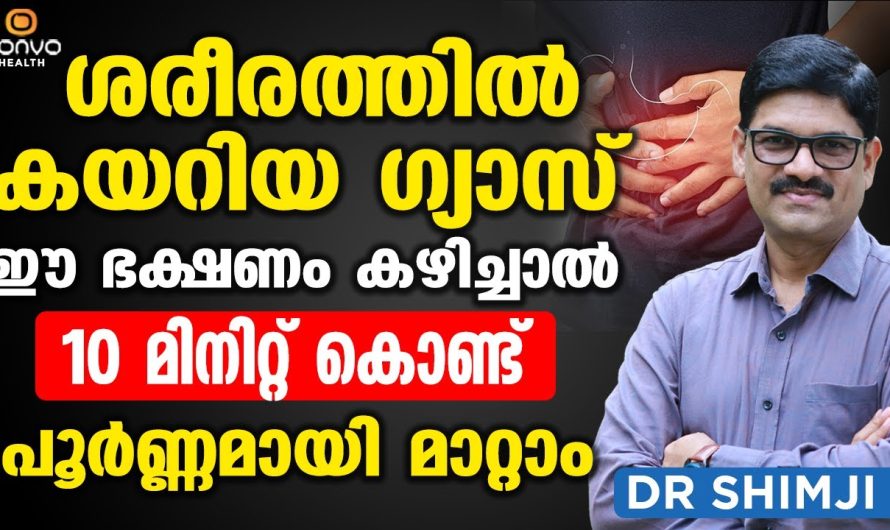 ഇത്തരം കാര്യങ്ങൾ ജീവിതത്തിൽ ശ്രദ്ധിച്ചാൽ ഗ്യാസ്ട്രബിൾ പ്രശ്നങ്ങൾ ഈസിയായി പരിഹരിക്കാം…