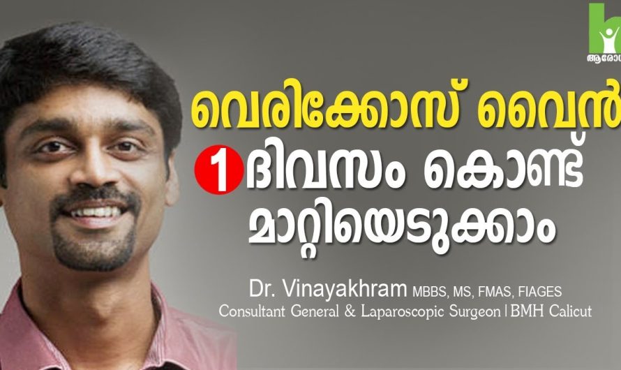 വെരിക്കോസ് വെയിൻ വരാതിരിക്കാനും വന്നത് പൂർണമായും മാറ്റാനും സഹായിക്കുന്ന രണ്ടു വഴികളെക്കുറിച്ച് മനസ്സിലാക്കാം…