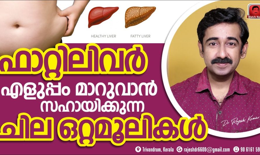 ഫാറ്റി ലിവർ സാധ്യതകൾ ഉണ്ടോ എന്ന് എങ്ങനെ നേരത്തെ തിരിച്ചറിയാം.. ഇതു വരാതിരിക്കാൻ ഭക്ഷണരീതിയിൽ ശ്രദ്ധിക്കേണ്ട കാര്യങ്ങളെക്കുറിച്ച് മനസ്സിലാക്കാം…