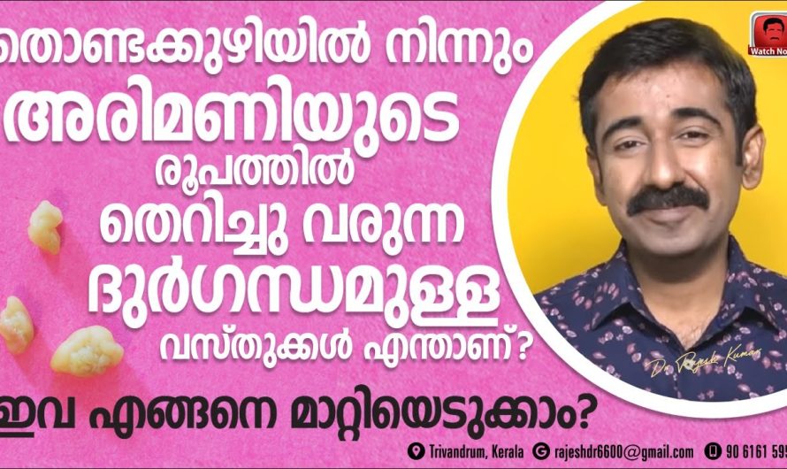 നിങ്ങളുടെ വായയുടെ ഉള്ളിൽ നിന്നും ചെറിയ അരിമണിയുടെ രൂപത്തിലുള്ള വസ്തുക്കൾ ഇടയ്ക്ക് വരുന്നത് കാണാറുണ്ടോ? എങ്കിൽ ഈ ഇൻഫർമേഷൻ അറിയാതെ പോകരുത്…