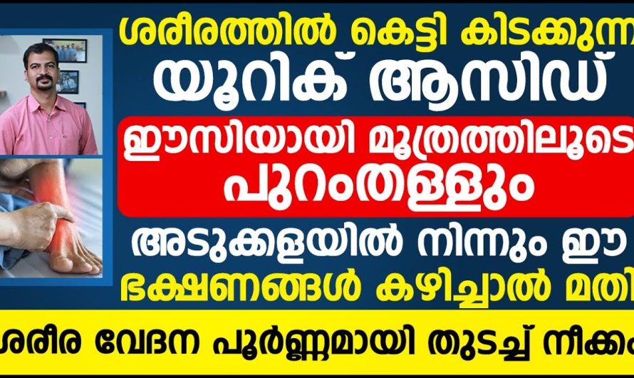 ശരീരത്തിൽ യൂറിക്കാസിഡ് അടിഞ്ഞുകൂടാതിരിക്കാൻ ഈ പറയുന്ന കാര്യങ്ങൾ ശ്രദ്ധിച്ചാൽ മതി…