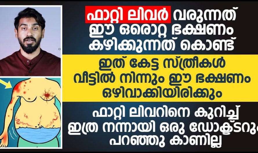 ഫാറ്റി ലിവർ സാധ്യതകളെ മരുന്നുകൾ ഇല്ലാതെ വീട്ടിലിരുന്നു കൊണ്ട് തന്നെ മാറ്റിയെടുക്കാൻ സാധിക്കുന്ന കാര്യങ്ങളെക്കുറിച്ച് മനസ്സിലാക്കാം…