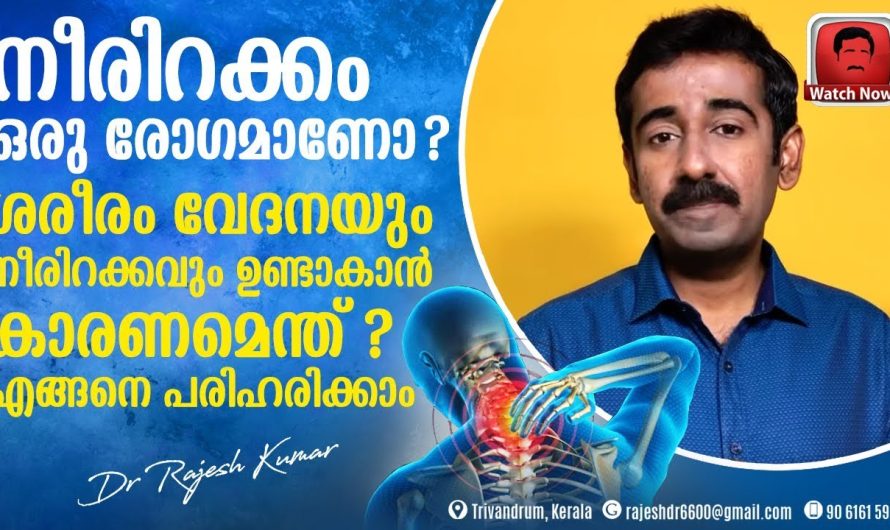 ശരീരത്തിൽ ഉണ്ടാകുന്ന നീരിറക്കം എന്ന പ്രശ്നത്തിന് പിന്നിലെ കാരണങ്ങളെ കുറിച്ചും പരിഹാര മാർഗങ്ങളെ കുറിച്ചും മനസ്സിലാക്കാം…