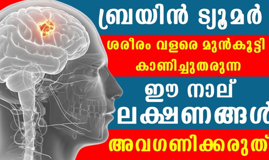 Brain Tumor: Main Causes and Risk Factors