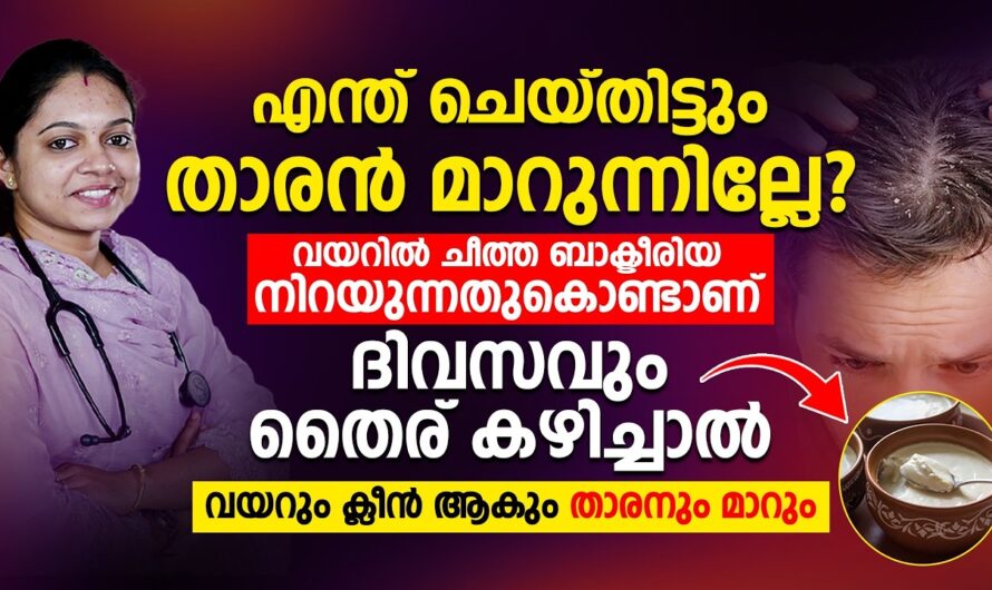 Why does dandruff occur? 6 reasons you may not notice!