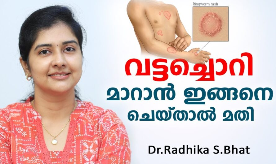 Why does ringworm occur? Don’t ignore these reasons!