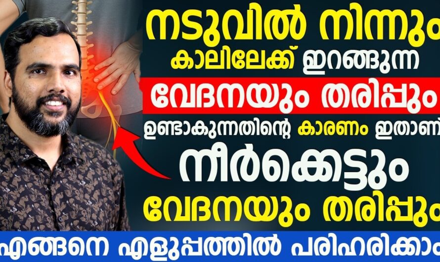 Does back pain spread to the legs? Top 6 causes!