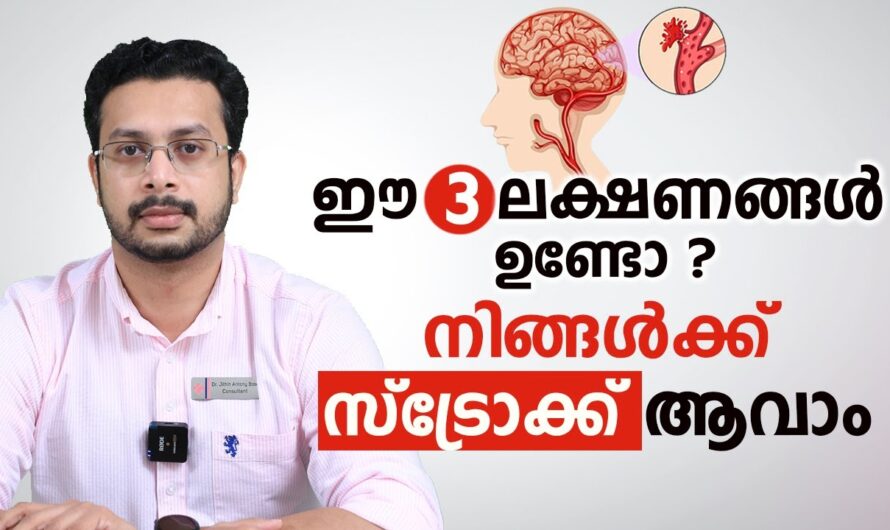 Stroke Symptoms Can Be Recognized; Every Moment is Precious!