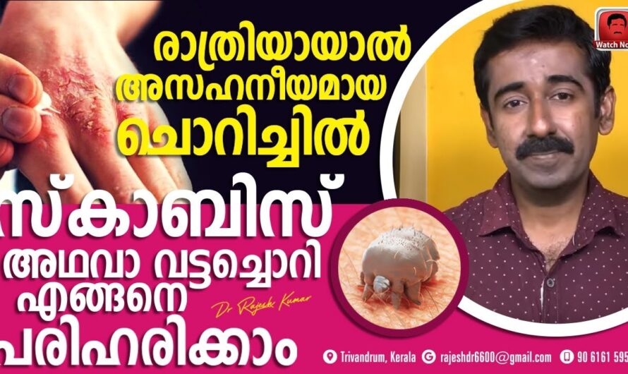 Ringworm won’t go away? Causes and solutions you should know