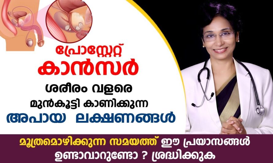 Prostate Cancer: Causes and Risk Factors