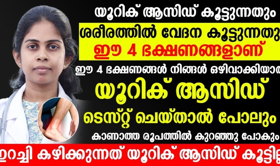 6 main reasons for increased uric acid