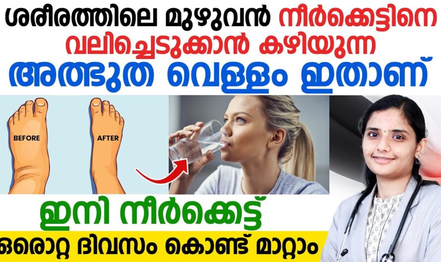 Why does the body get edema? 6 reasons you should know!