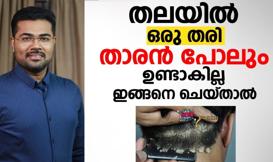 Why does dandruff occur? Know these reasons