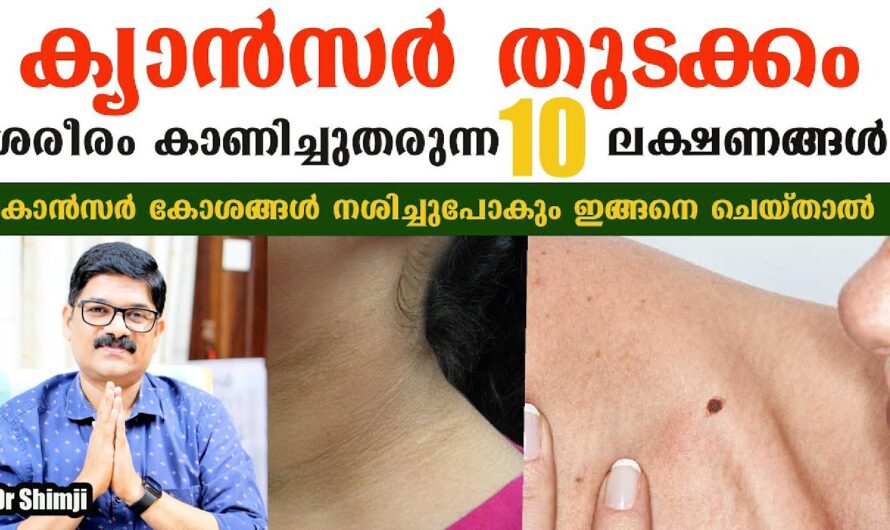 Why does cancer occur? The main reasons you should know!