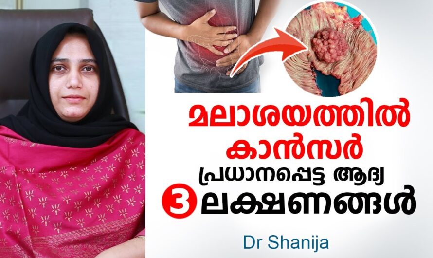 Why does rectal cancer occur? 6 reasons you should know!