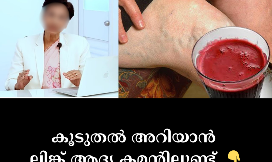 Are varicose veins a common problem? Identify the 5 main causes that lead to varicose veins