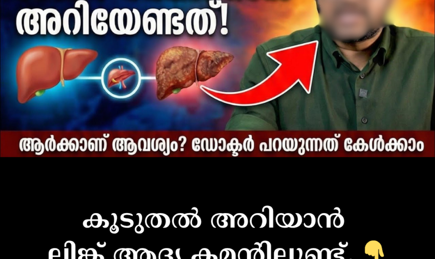 Liver Transplant: When and Why? 5 Important Reasons to Know