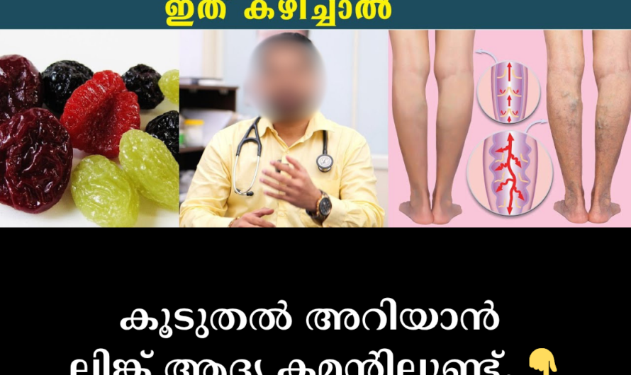 Are varicose veins a common problem? Identify the 5 main causes that lead to varicose veins