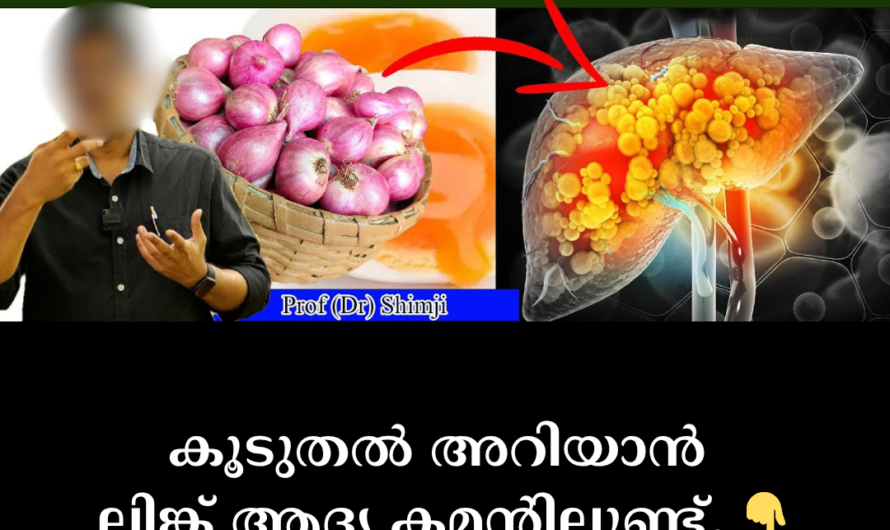 In the same format you requested, the article on the main causes of fatty liver is given below: