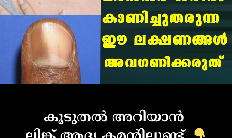 Colon Cancer: Don’t Ignore These Symptoms! 5 Major Causes That Increase Your Risk