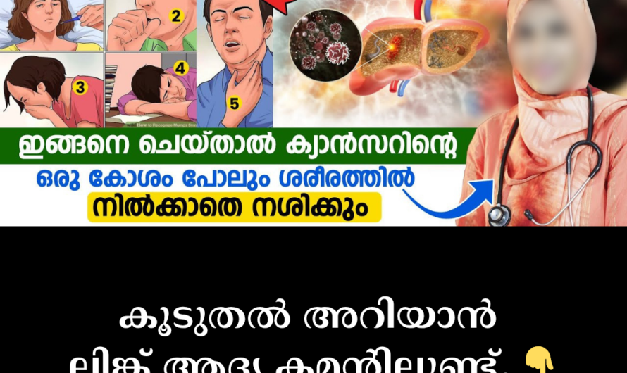 Colon Cancer: Don’t Ignore These Symptoms; 5 Main Causes