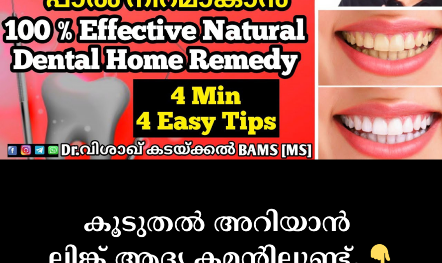 Get rid of yellow teeth and brighten your smile! Causes and solutions