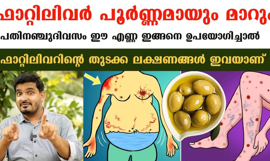 In the same format you requested, the article on the main causes of fatty liver is given below: