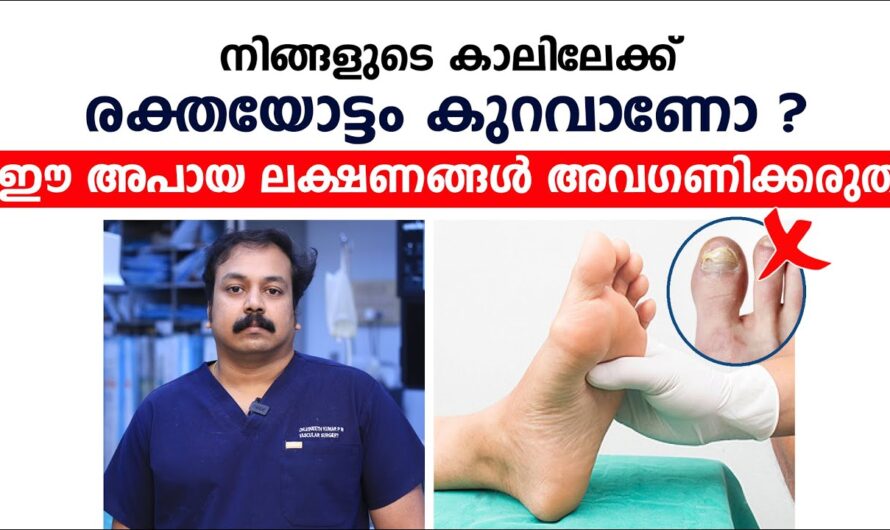 Feeling tired all over your body and feeling numb in your arms and legs? Here are 5 main causes of poor blood circulation