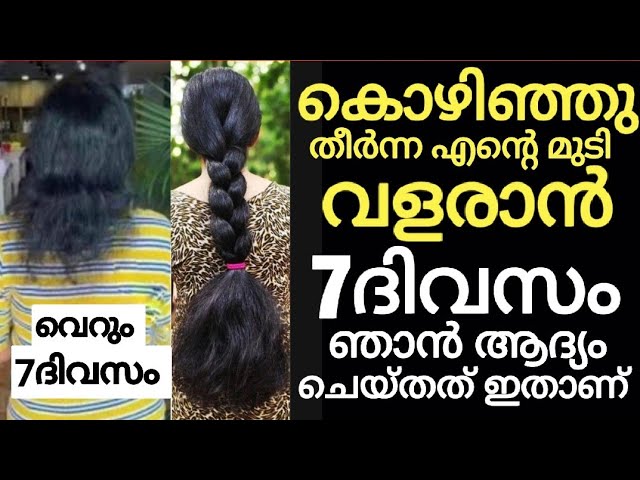 Hair loss can be reversed and hair can grow like a forest; Here are 5 natural ways!