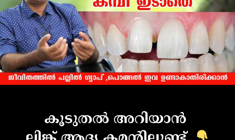 How to prevent teeth from protruding? Is there a solution without braces? 5 things to know