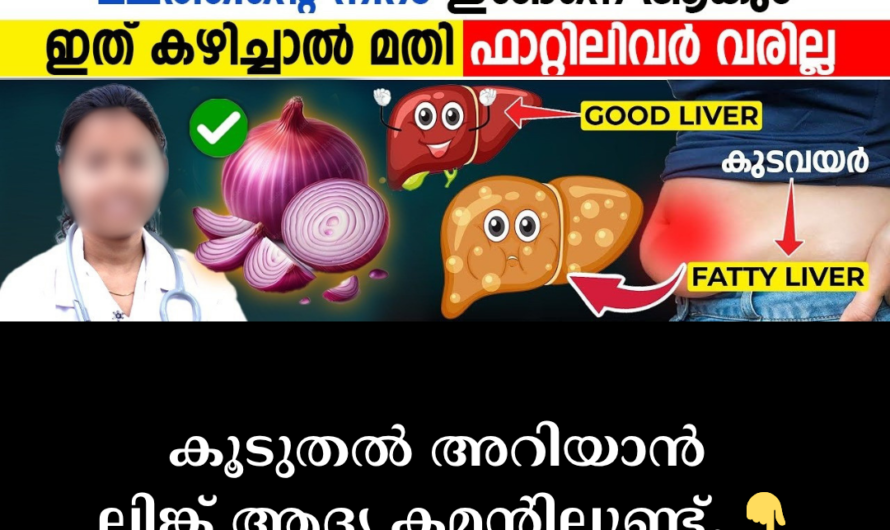 Let’s protect the liver! 5 main reasons leading to fatty liver