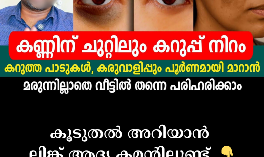 Do you have dark circles under your eyes? 5 main reasons that dull your face
