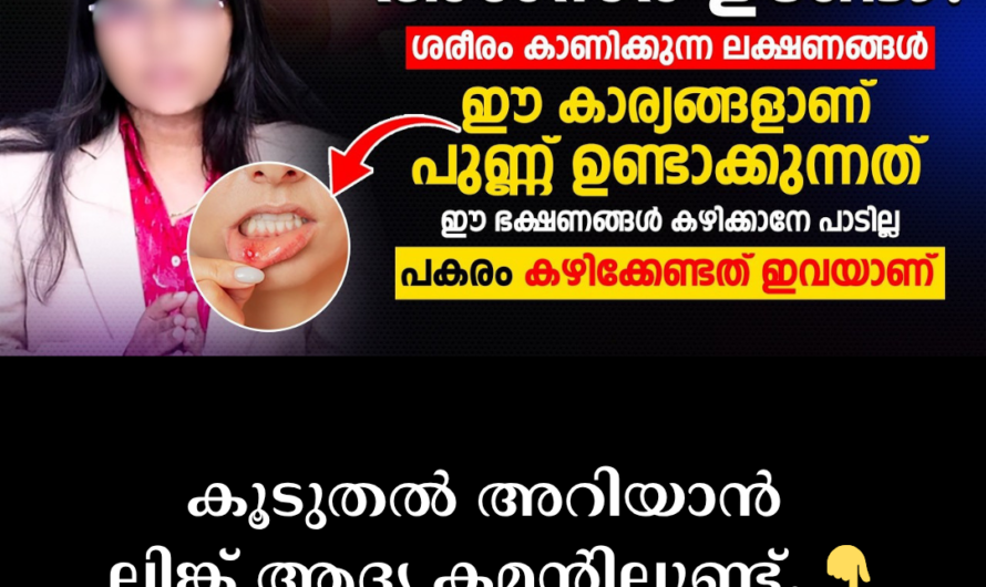 Chronic heartburn and stomach pain can be ulcers; 5 main causes