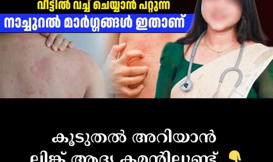 Are you bothered by chronic sneezing and itching? 5 main causes behind allergic diseases