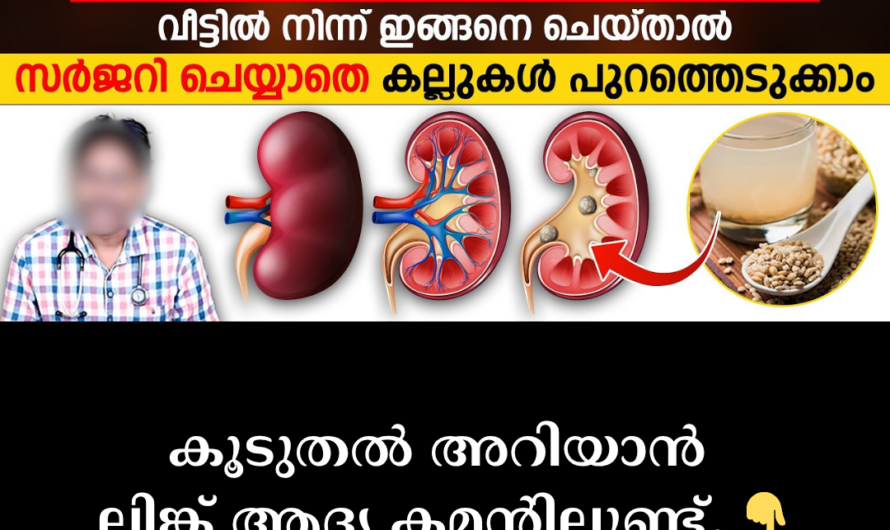Do you have severe pain that radiates from the middle to the lower abdomen? 5 things that cause kidney stones
