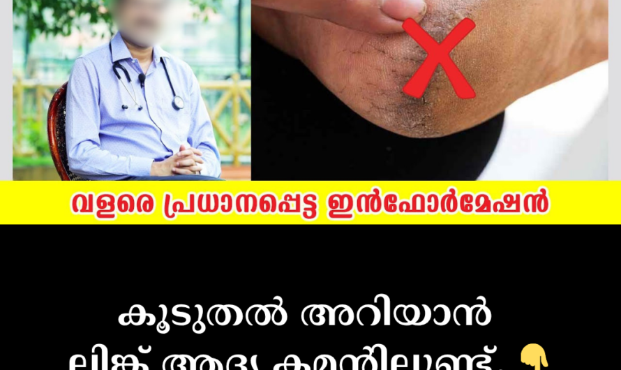 Do you have severe pain and swelling in the joints of your hands and feet? 5 things that cause arthritis