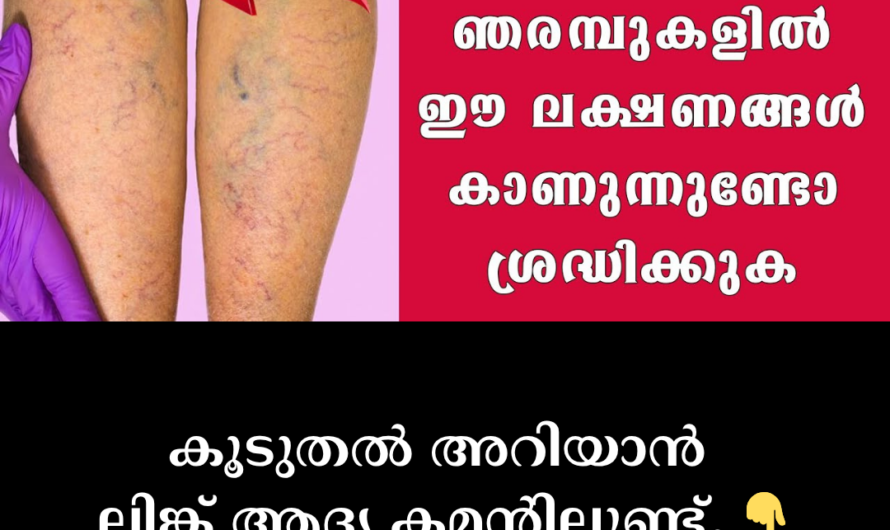 Do blue veins swell in the legs? 5 main things that cause varicose veins