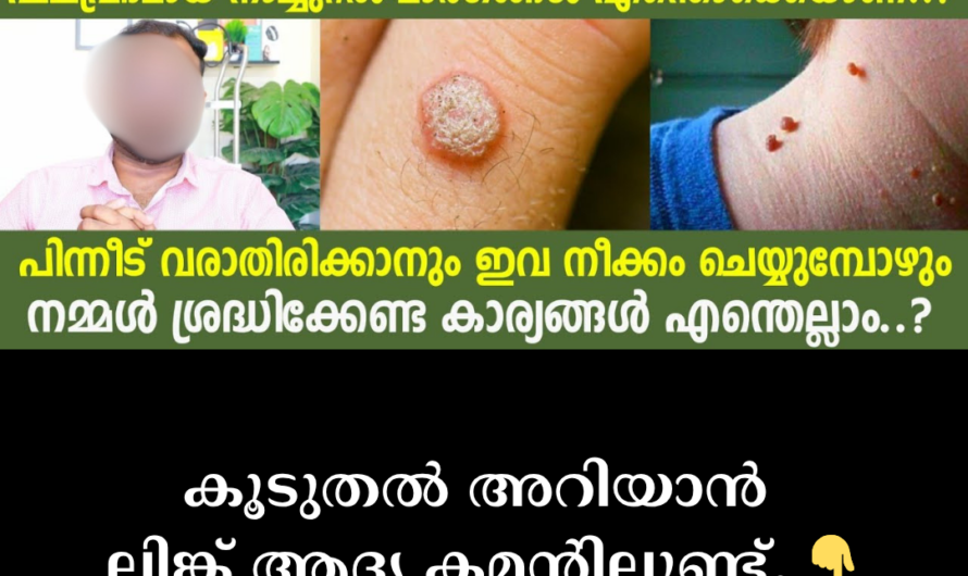 Are warts and moles growing on the neck and face? 5 main reasons for their occurrence