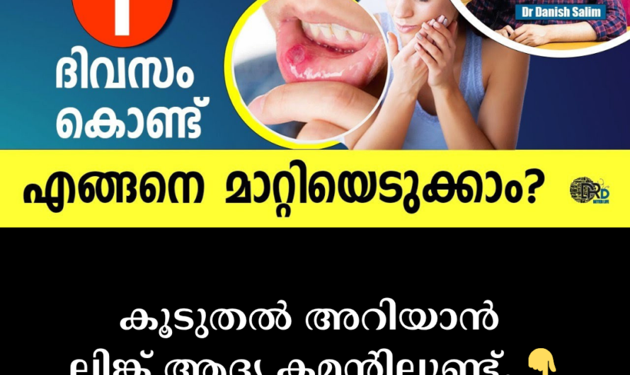 Here are the 5 main scientific reasons behind frequent mouth ulcers: