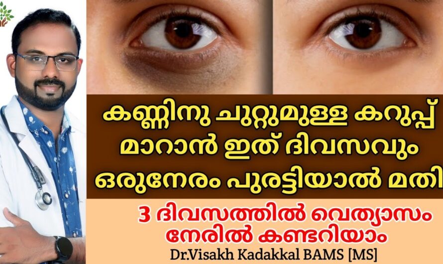 Dark circles under the eyes that always make you look tired! 5 main causes and solutions