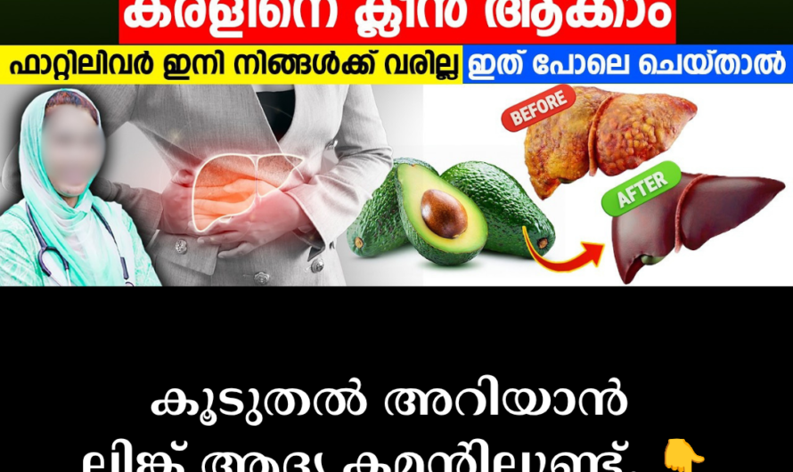 Fatty liver fills the liver without symptoms! 5 main scientific reasons behind fatty liver